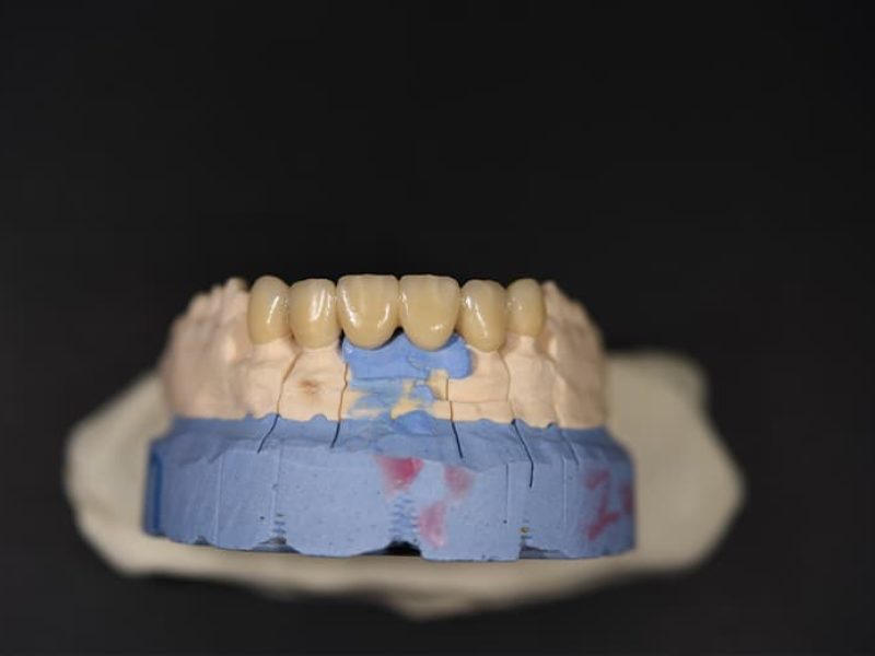 Γέφυρα-Ζιρκονίου