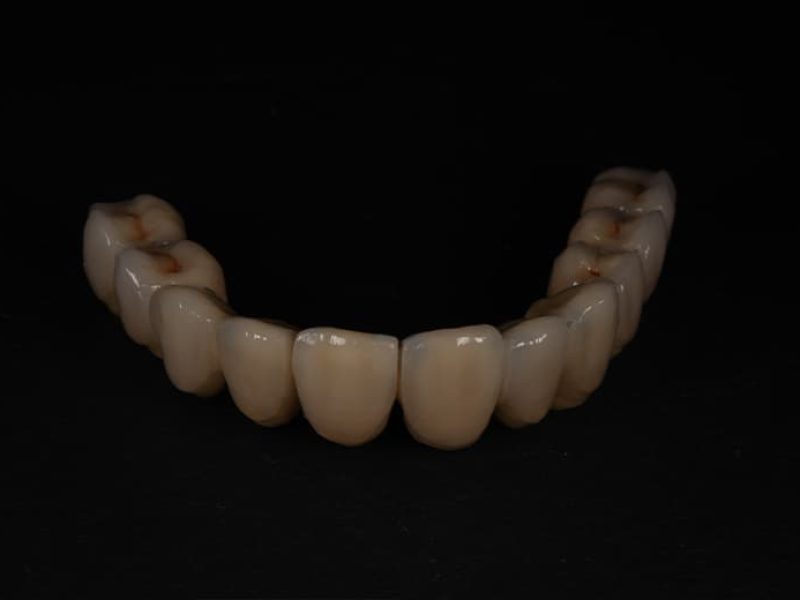 Επιεμφυτευματική-Συγκολούμενη