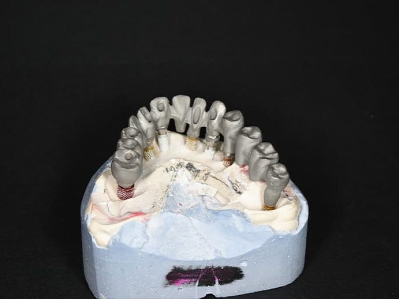 Επιμφυτευματική-Αποκατάσταση