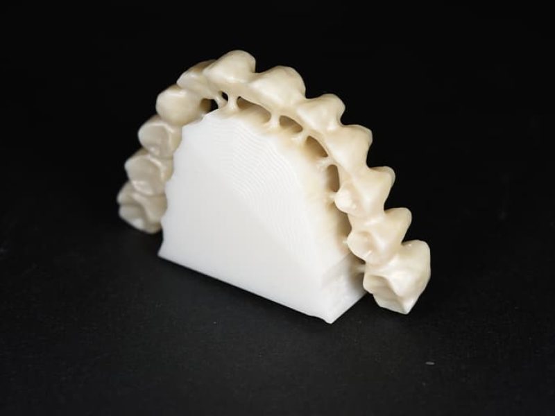 Ολοκεραμικές-Αποκαταστάσεις